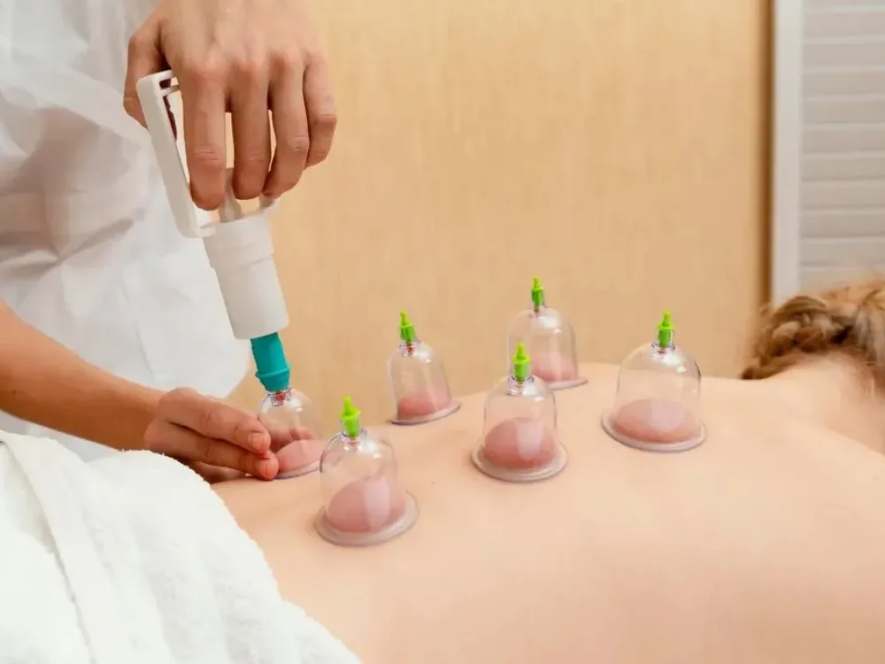 A therapist applies a suction pump to a row of cupping glasses placed along a patient's back during a myofascial decompression session.