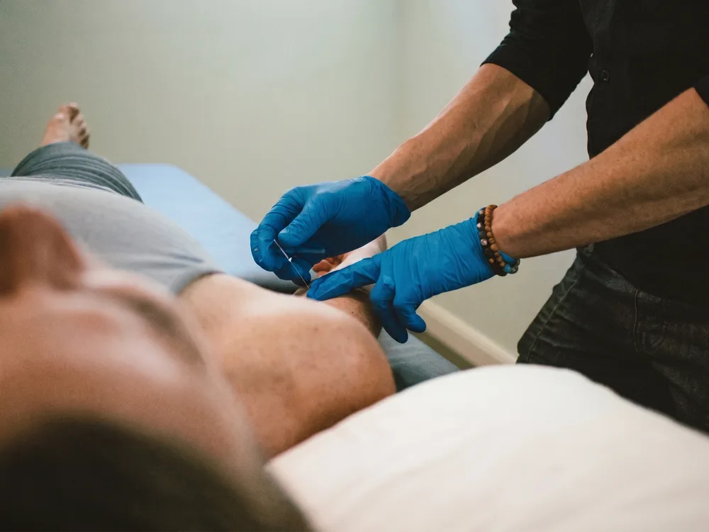 A gloved clinician inserts a thin dry needle into a patient's shoulder muscle while the patient lies on a treatment table.