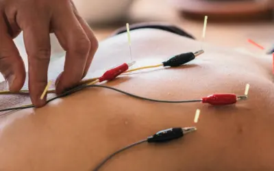 Dry Needling for Chronic Pain: A Natural Alternative to Pain Medication