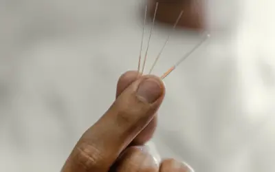 Who Can Benefit from Dry Needling? A Guide for Athletes and Active Individuals